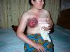 圖為王雲潔的右乳被電爛的慘狀
