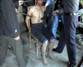 '酷刑演示：電擊'