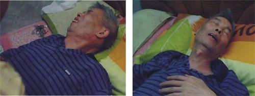 '謝德清被迫害得心中絞痛難忍，滿臉痛苦。'